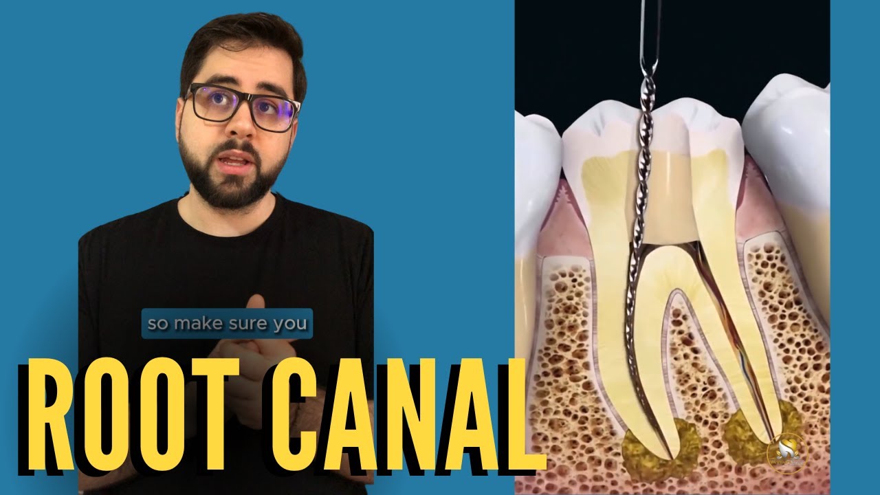 Root Canal Treatment