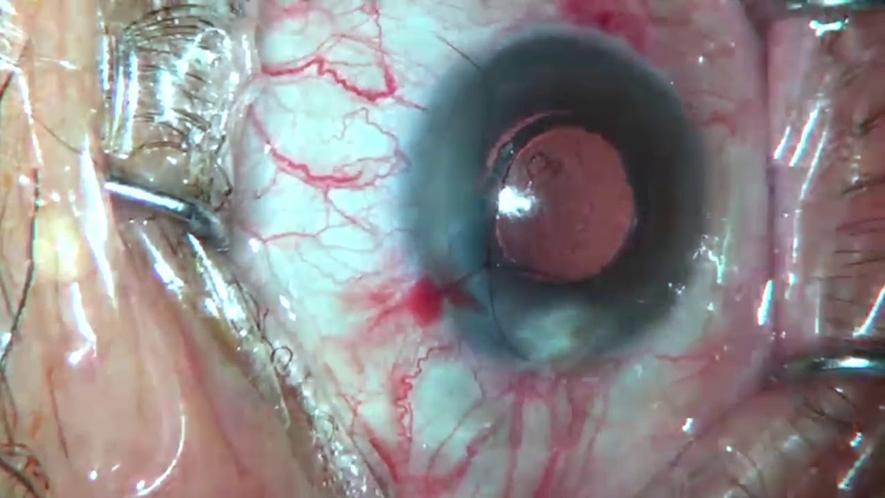 Blanca Esmeralda Hurtado Noriega-5