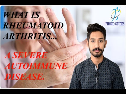 A vállízület polyarthrosis kezelése A kezek ízületeinek rheumatoid arthritis