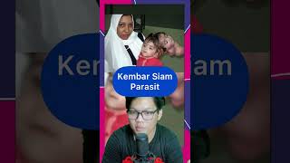 Download lagu Kembar Siam ada yang BERBAGI SUAMI  #shorts #shortsindonesia #indonesia mp3