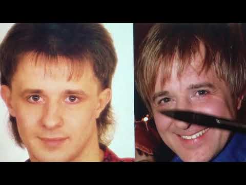 Nedokonalosti Petra Kotvalda: Kolikrát se svěřil do rukou plastického chirurga?