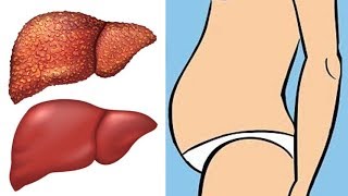 9 Warning Signs Your Liver Needs A Detox