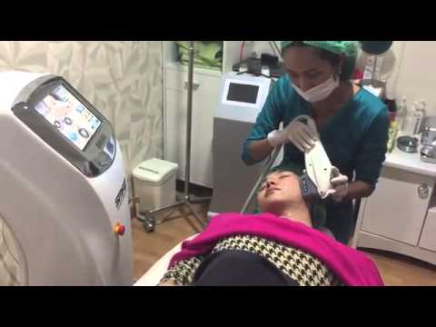 ผู้หญิง smskami Excite Exciter สำหรับผู้หญิงราคาซื้อ