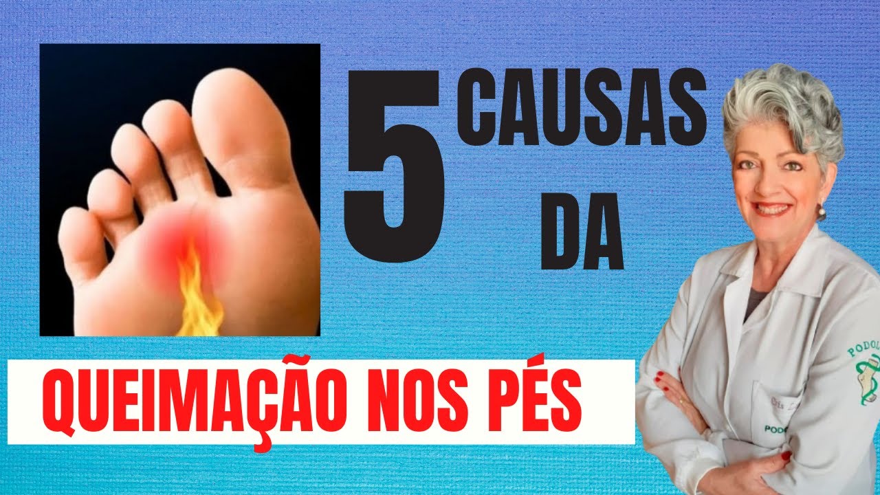 5 Causas Da Queimação Nos Pés