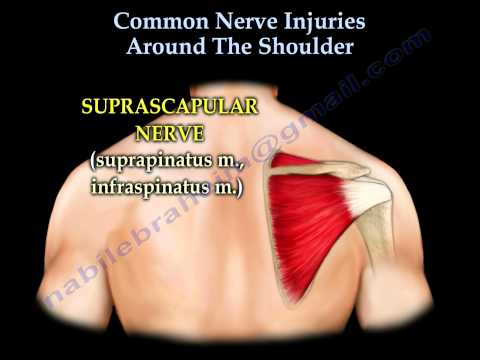Shoulder Nerve injury ,Injuries  - Everything You Need To Know - Dr. Nabil Ebraheim