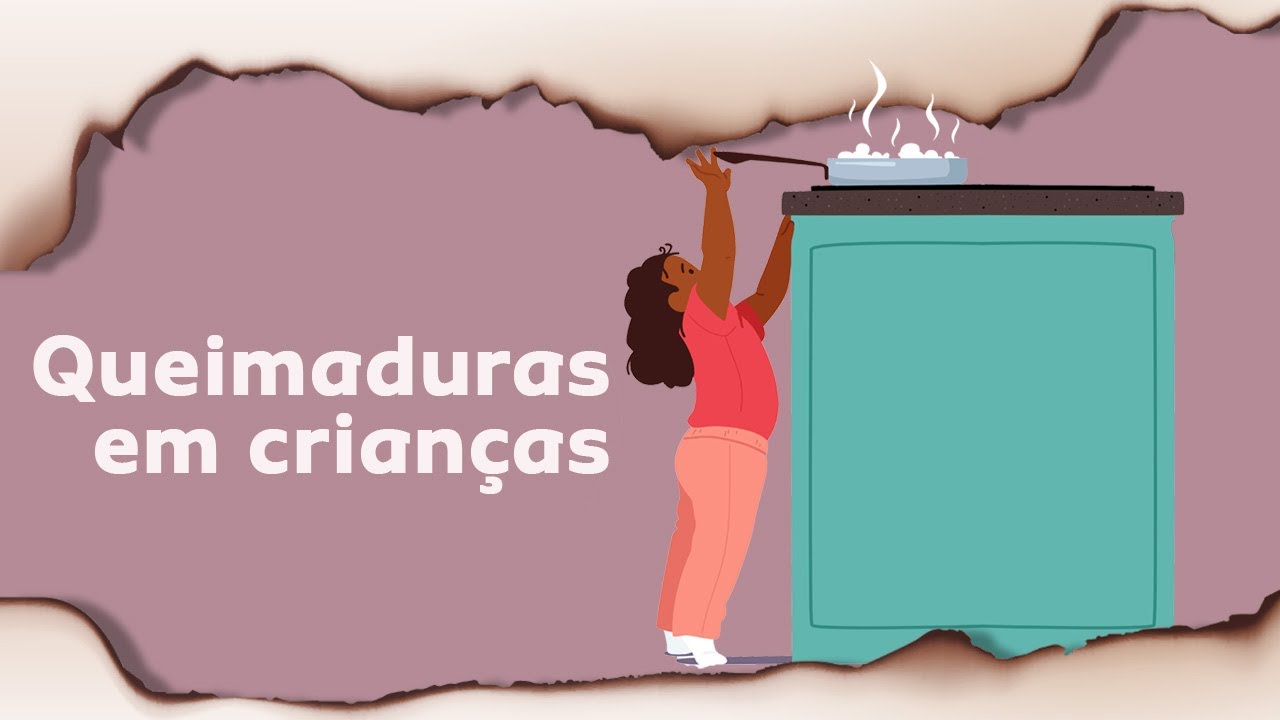 Queimaduras Severas: Progresso na Medicina e História de Esperança