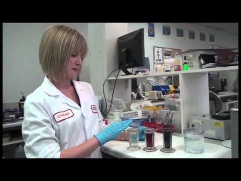 Preparing and Staining Blood Film