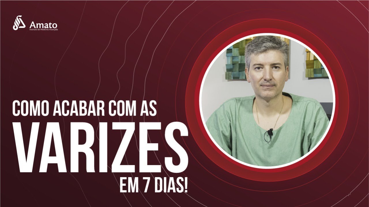 Como Acabar com as Varizes em 7 Dias