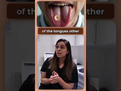 🚨 Early Signs of Mouth Cancer You Shouldn't Ignore 🚨 #shorts #dentist