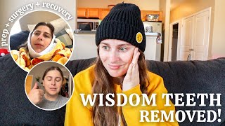 The Prep, Surgery Day, & Recovery for my Wisdom Teeth Removal | Age 25 & TERRIFIED lol