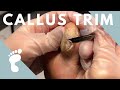 SMOOTH + SATISFYING CALLUS TRIM