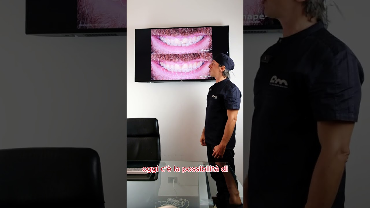 Ortodonzia con Invisaling e faccette estetiche