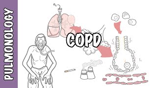 Understanding COPD - Chronic obstructive pulmonary disease cause, pathophysiology and treatment