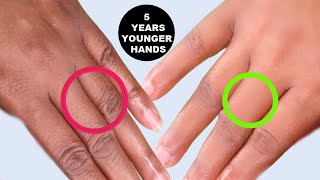MAKE YOUR HANDS LOOK 5 YEARS YOUNGER, REMOVE WRINKLES, TREAT DRY HANDS, ROUGH HANDS, SMOOTH HYDRATED
