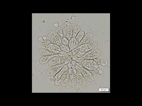 Ciliate - Opercularia peritrich colony - compost microbe