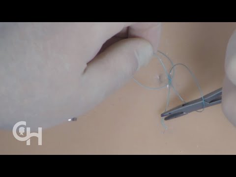 Suture Basics: Horizontal Mattress