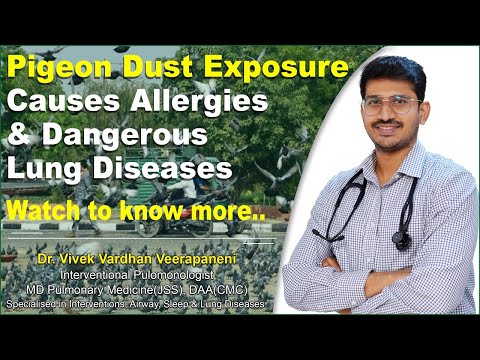 , title : 'What Happens When We Inhale Pigeon Dust and Dirt | Allergies, and Lungs Diseases | Dr.Vivek |'