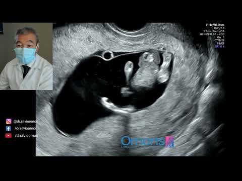 A Little Prince on Board: Unveiling the Secrets of a 12-Week-Old Baby