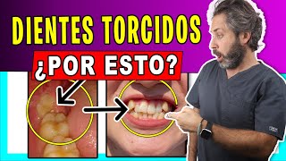 🟣¿Las 𝗠𝗨𝗘𝗟𝗔𝗦 𝗗𝗘𝗟 𝗝𝗨𝗜𝗖𝗜𝗢 MUEVEN los DIENTES(Descúbrelo) Porque se APIÑAN los dientes en adultos