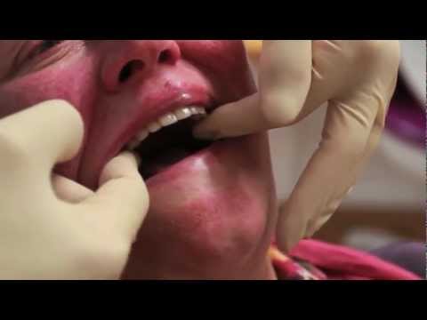 Zahnarztpraxis Dr. Jörg Strotmann: Vollprothesen