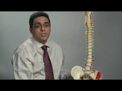 Degenerative changes of the spine | Ohio State Medical Center