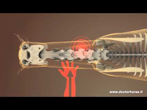 Osteocondrosi del saggio rachide lombosacrale Mal di schiena si irradia alla mandibola