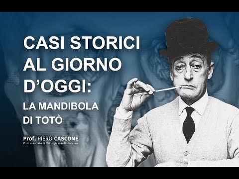 Casi storici al giorno d'oggi: la mandibola storta di Totò