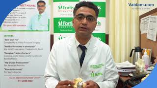 Hip Arthroplasty Explained by Dr. Puneet Mishra of Fortis Hospital, New Delhi