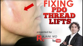 HOW TO FIX PDO THREAD LIFT PUCKERING COMPLICATIONS-PDO Thread Visibility Dimpling Nodules Dr Rajani