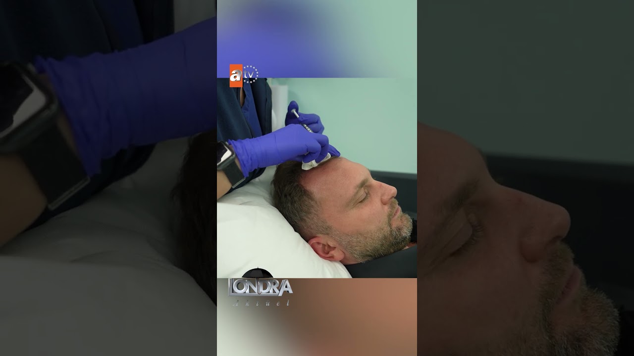 İnce telli saçları güçlendiren özel uygulama… / Londra Aktüel 337. Bölüm