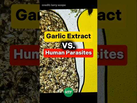 Garlic Extract vs. Parasitic Worms – You Won’t Believe This! 🧄🧬