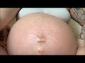 Active Moving Belly