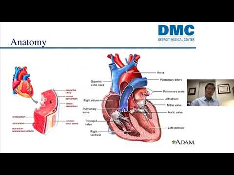 Infective Endocarditis