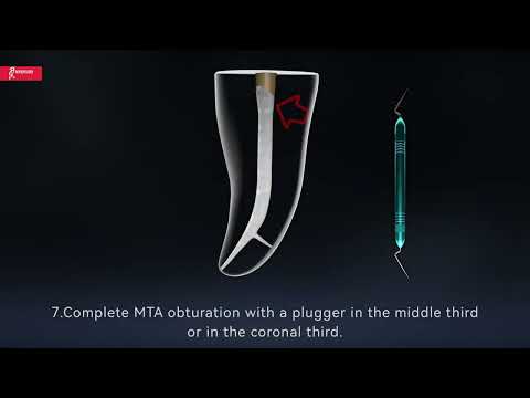 WoodPecker 812MT | Prof.Dr.Yoshi Terauchi