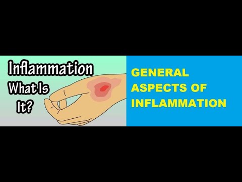 GENERAL PATHOLOGY II CHAPTER 3 II INFLAMMATION REPAIR II GENERAL ASPECTS OF INFLAMMATION II ROBBIN