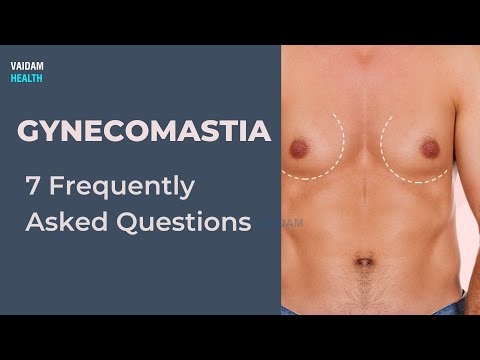 Enlarged male breasts 7 Frequently Asked Questions (Gynecomastia)