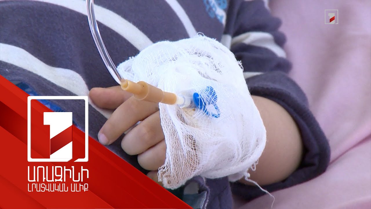 Հայաստանում գլուխ է բարձրացնում քութեշը