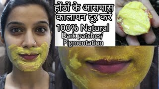 How To Remove Dark Black Patches,Dark Spots, Pigmentation Around Mouth Area | Super Style Tips