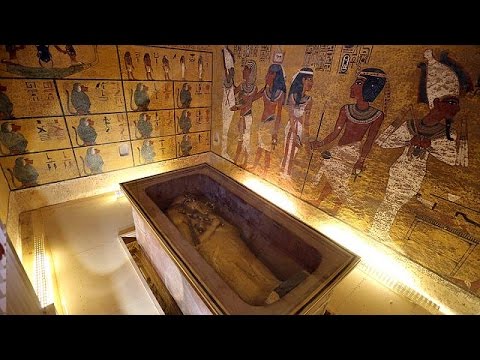Articolazioni dellanca Giunti Prezzo protesi danca a Samara
