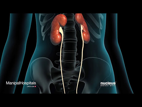 Trattamento ape Podmore di adenoma prostatico Metodi di trattamento BPH