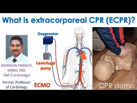 What is extracorporeal CPR (ECPR)?