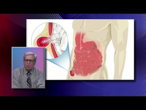 hogyan kell inni csalán a prostatitis