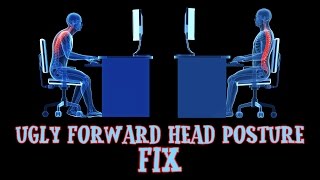 Ugly Forward Head Posture Fix