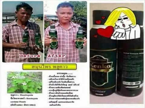 โรคสะเก็ดเงินปรากฏตัวเป็นเล็บ ยาเสพติดโรคสะเก็ดเงิน Fufaev