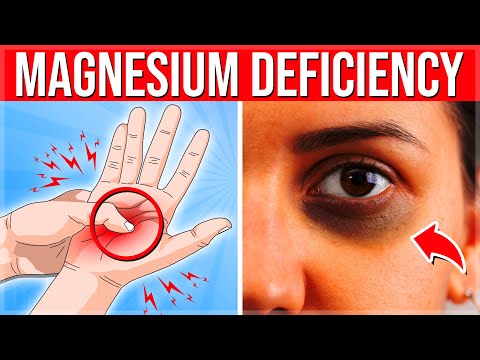 12 WARNING Signs Your Body NEEDS MORE Magnesium Magnesium Deficiency Symptoms
