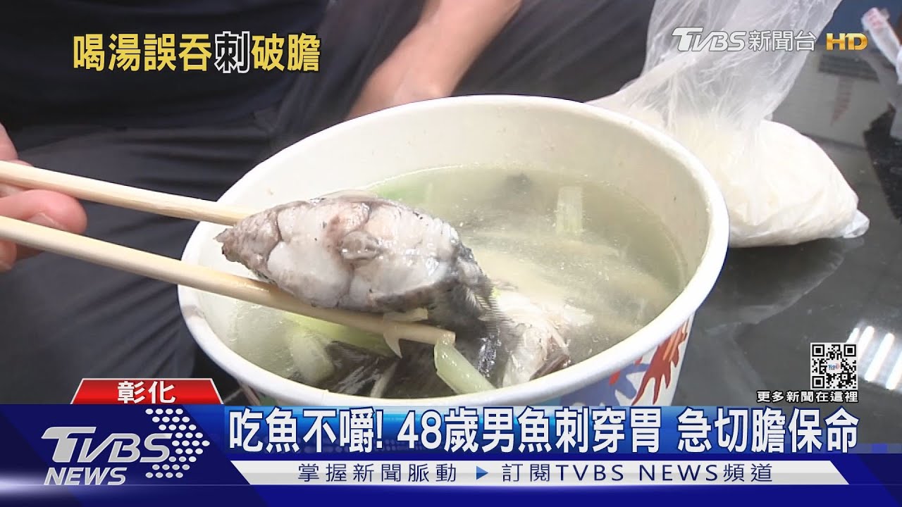吃魚不嚼!48歲男魚刺穿胃 急切膽保命