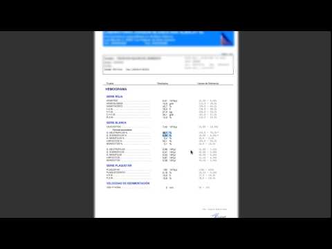 MIS ANÁLISIS DE TESTOSTERONA : INTERPRETANDO LOS RESULTADOS
