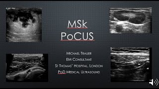 Musculoskeletal PoCUS