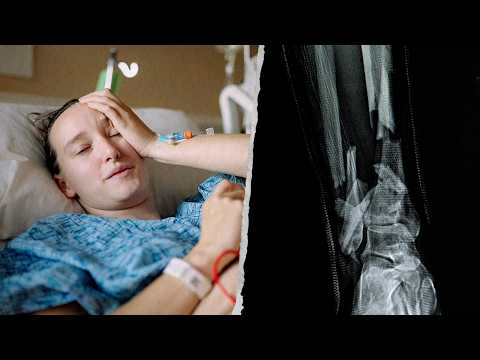 I Nearly Lost My Leg In a Rock Climbing Accident