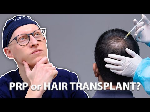 PRP vs Hair Transplant | Dr. Gary Linkov